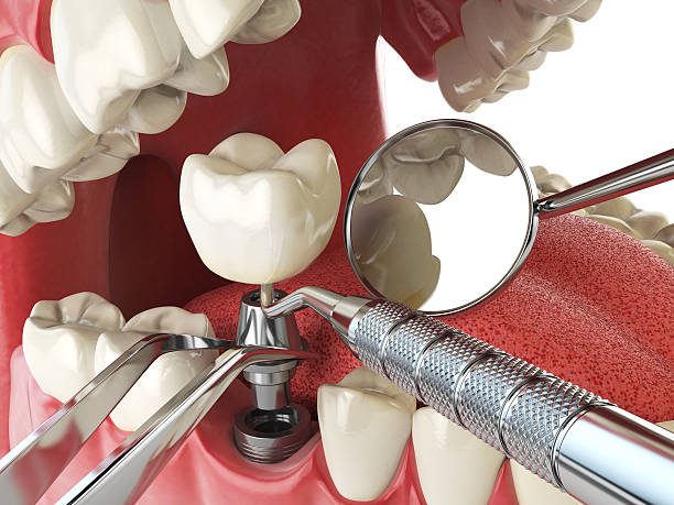 Best Emergency Gum Treatment in Dexter, OR